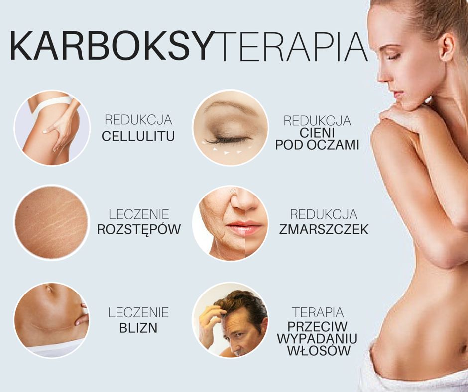 Co To Jest Karboksyterapia Dermabell 6894